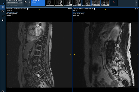 sirona-viewer-new